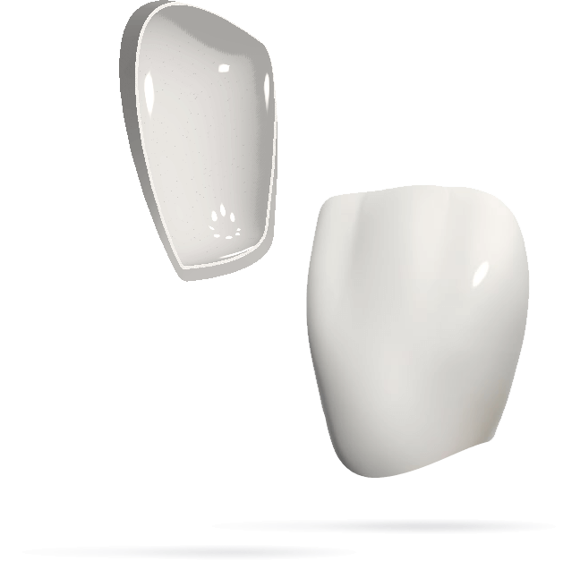 Tout savoir sur la facette dentaire